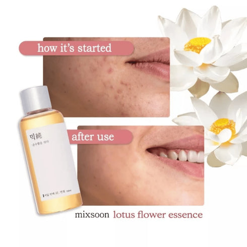 Lotus Flower Essence 100 ml - WowSkin Romania